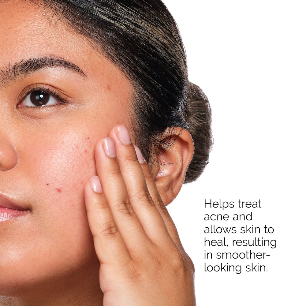 Acne Clear 3-Step Kit