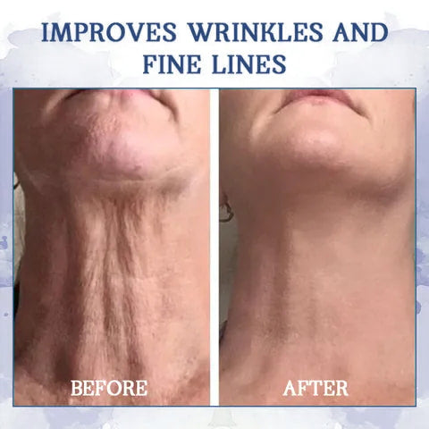 Restore Neck Elasticity Cream