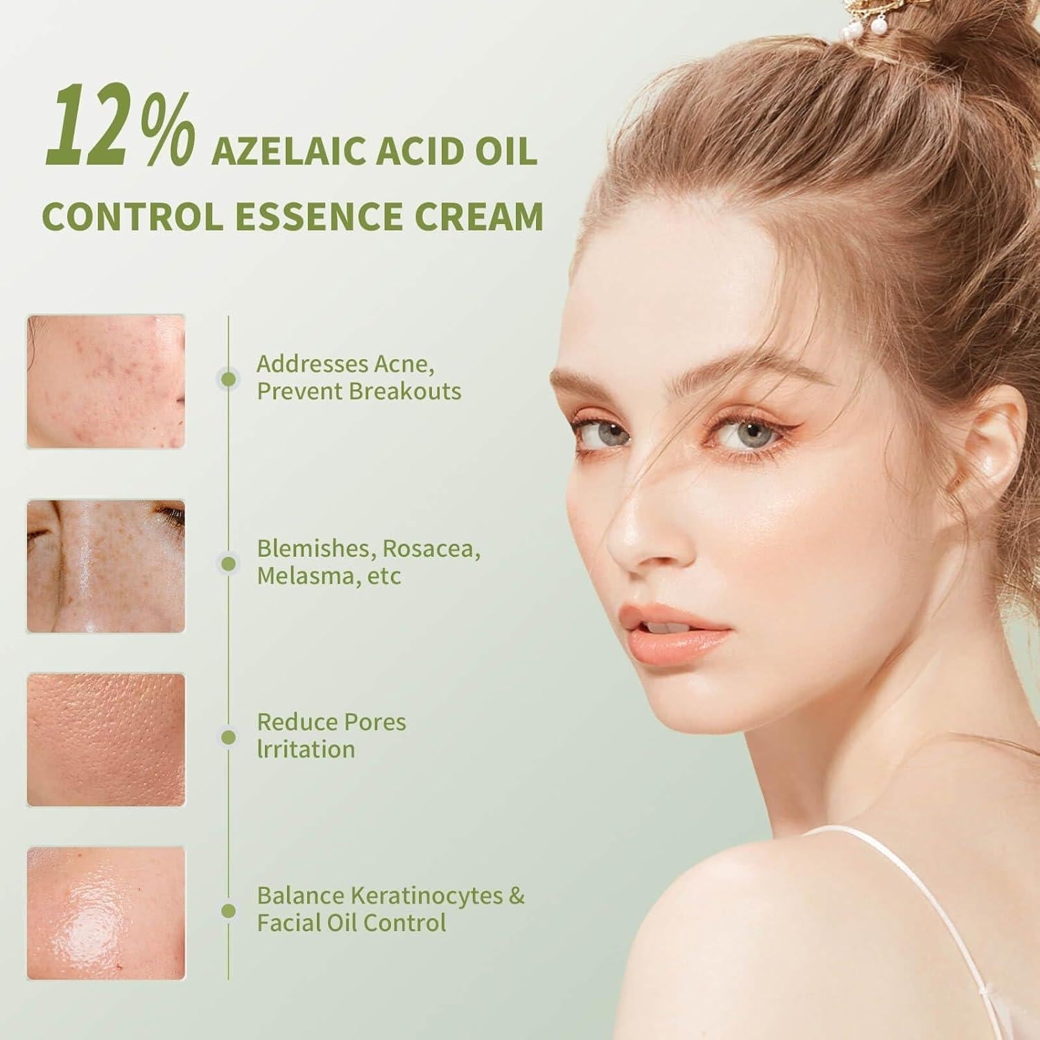 VGO Anti-Acne Essence
