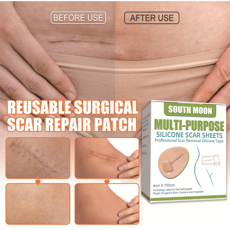 Silicone Scar Sheets for Al