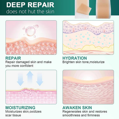 Silicone Scar Sheets for Al