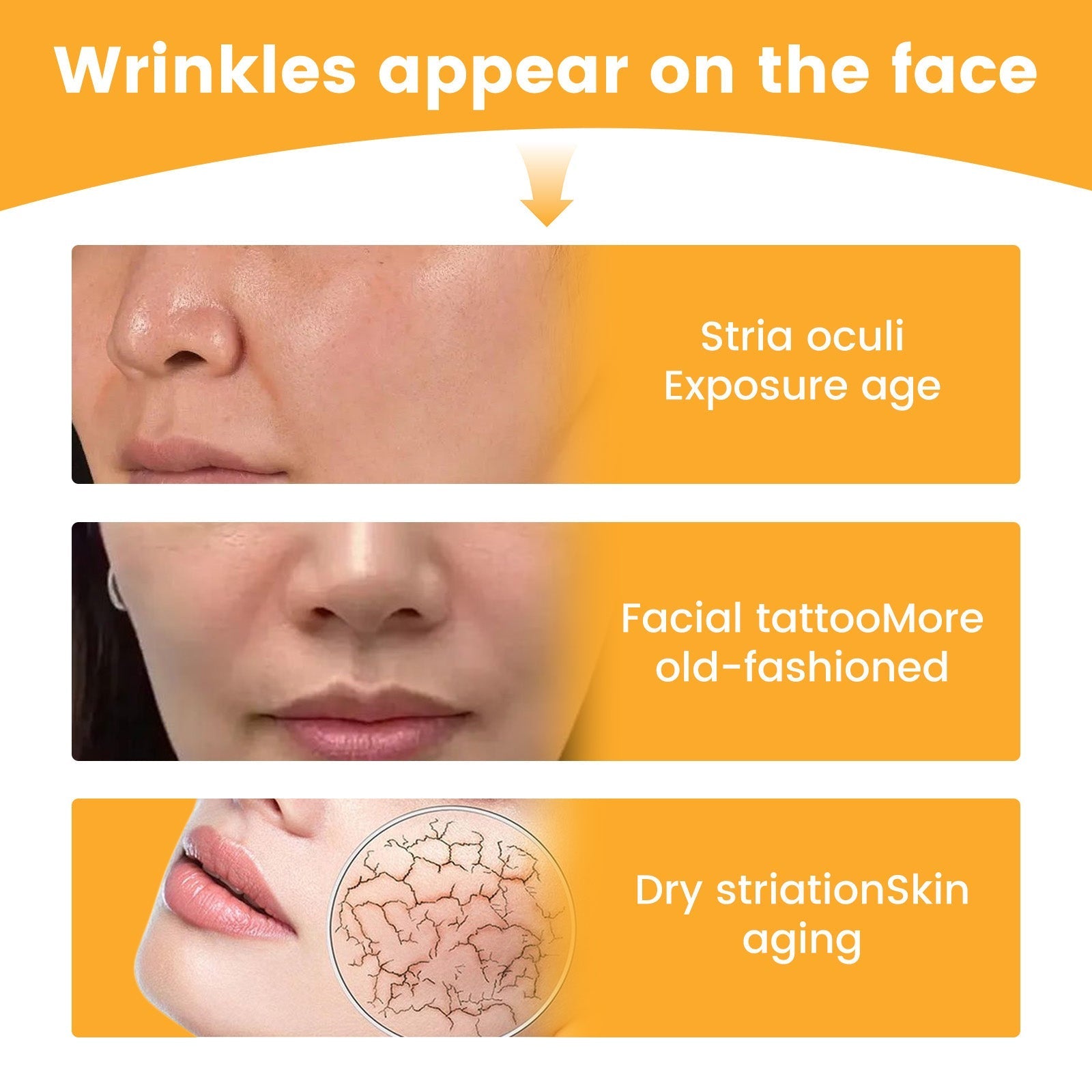 Nasolabial Folds Repair Patch