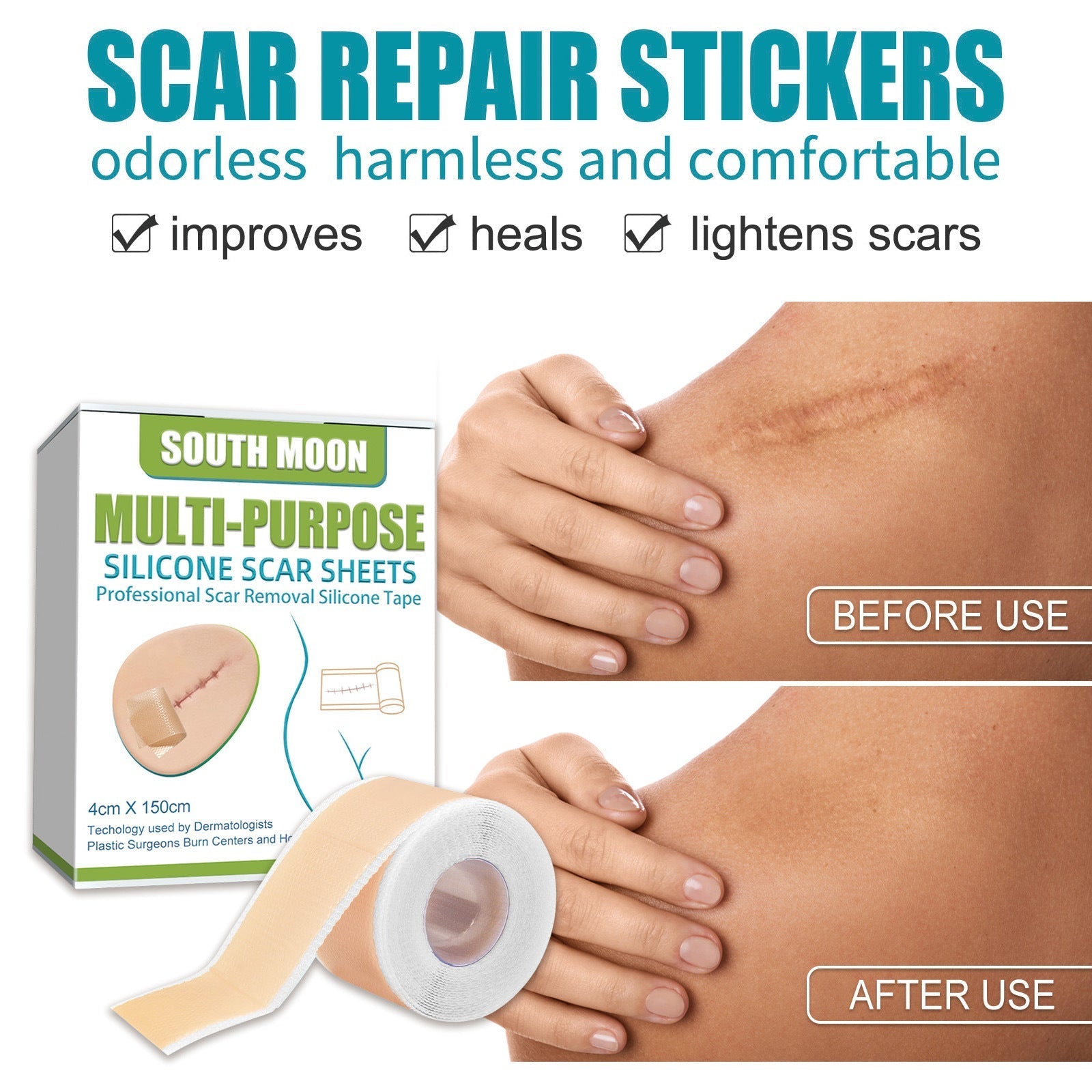 Silicone Scar Sheets for Al