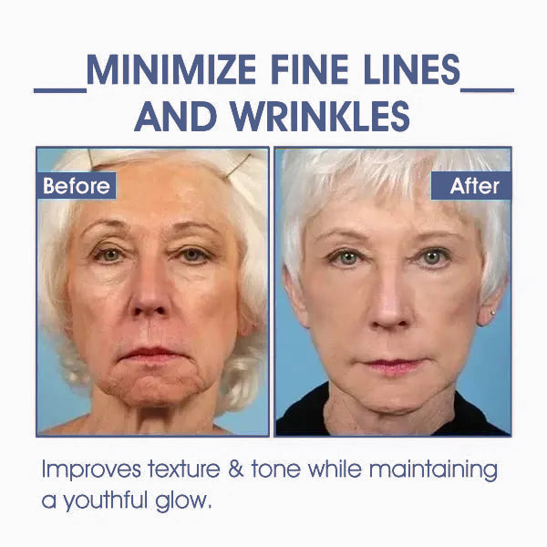 Restore Neck Elasticity Cream