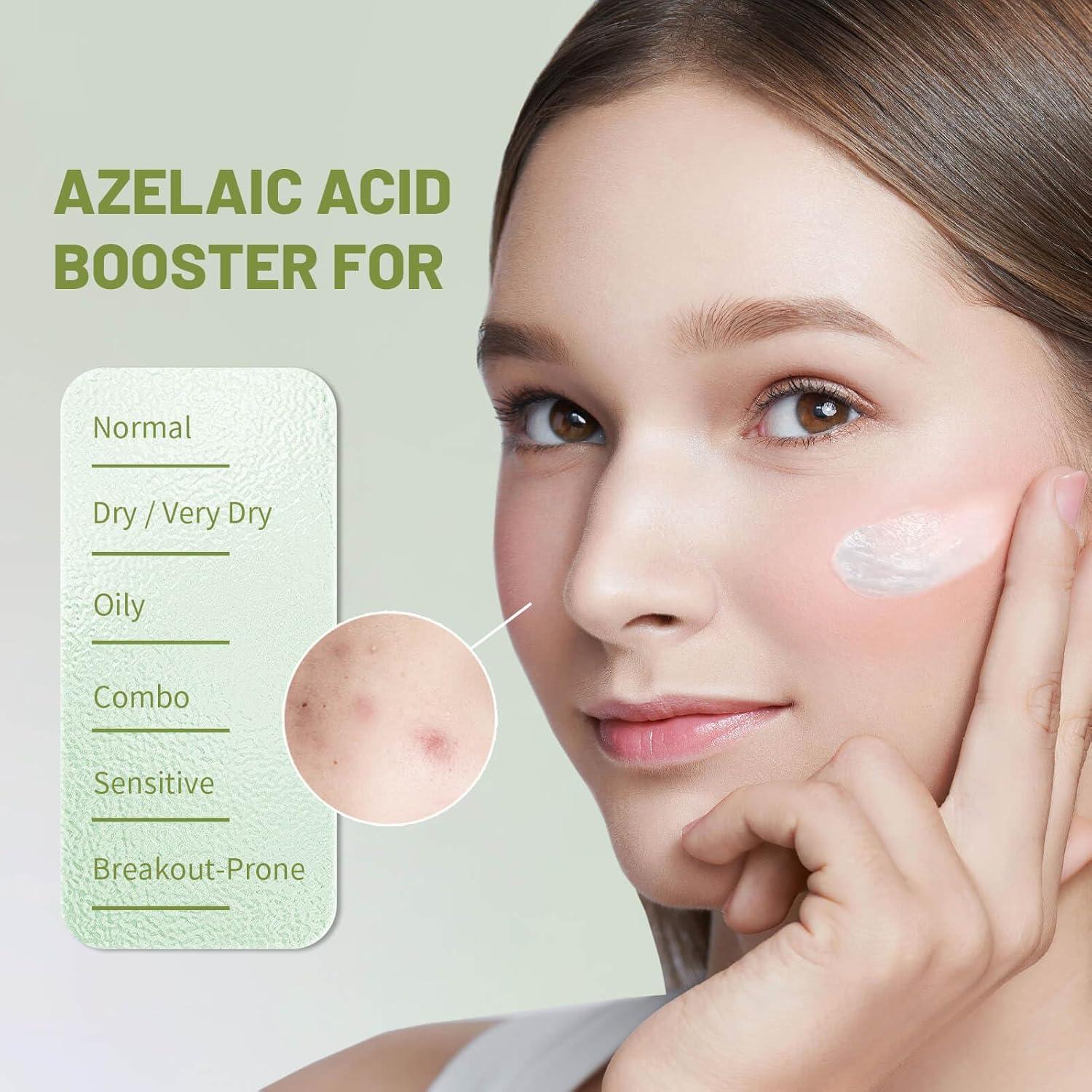 VGO Anti-Acne Essence