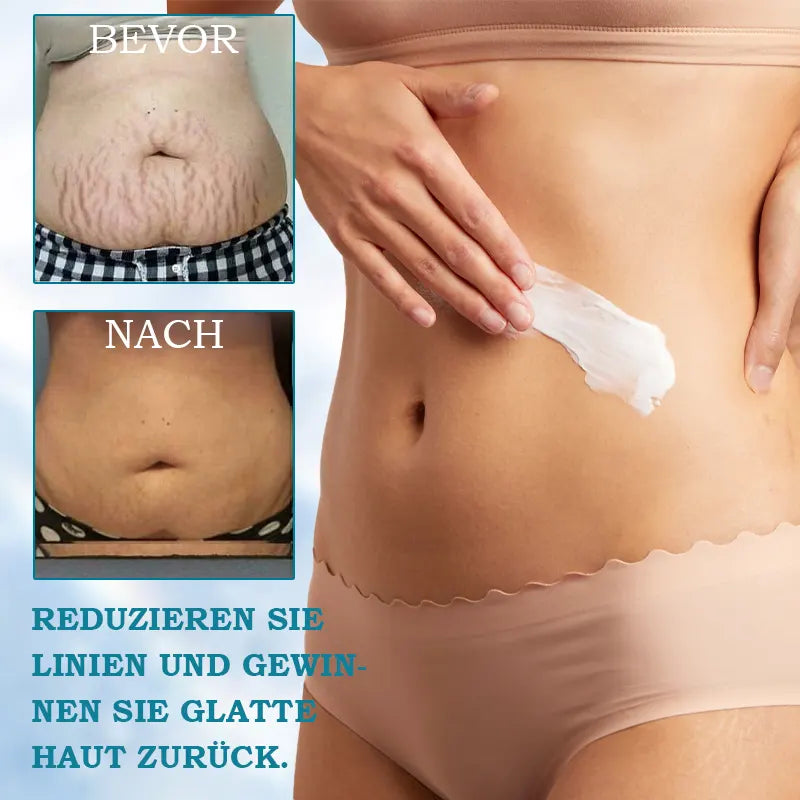 Restore Neck Elasticity Cream