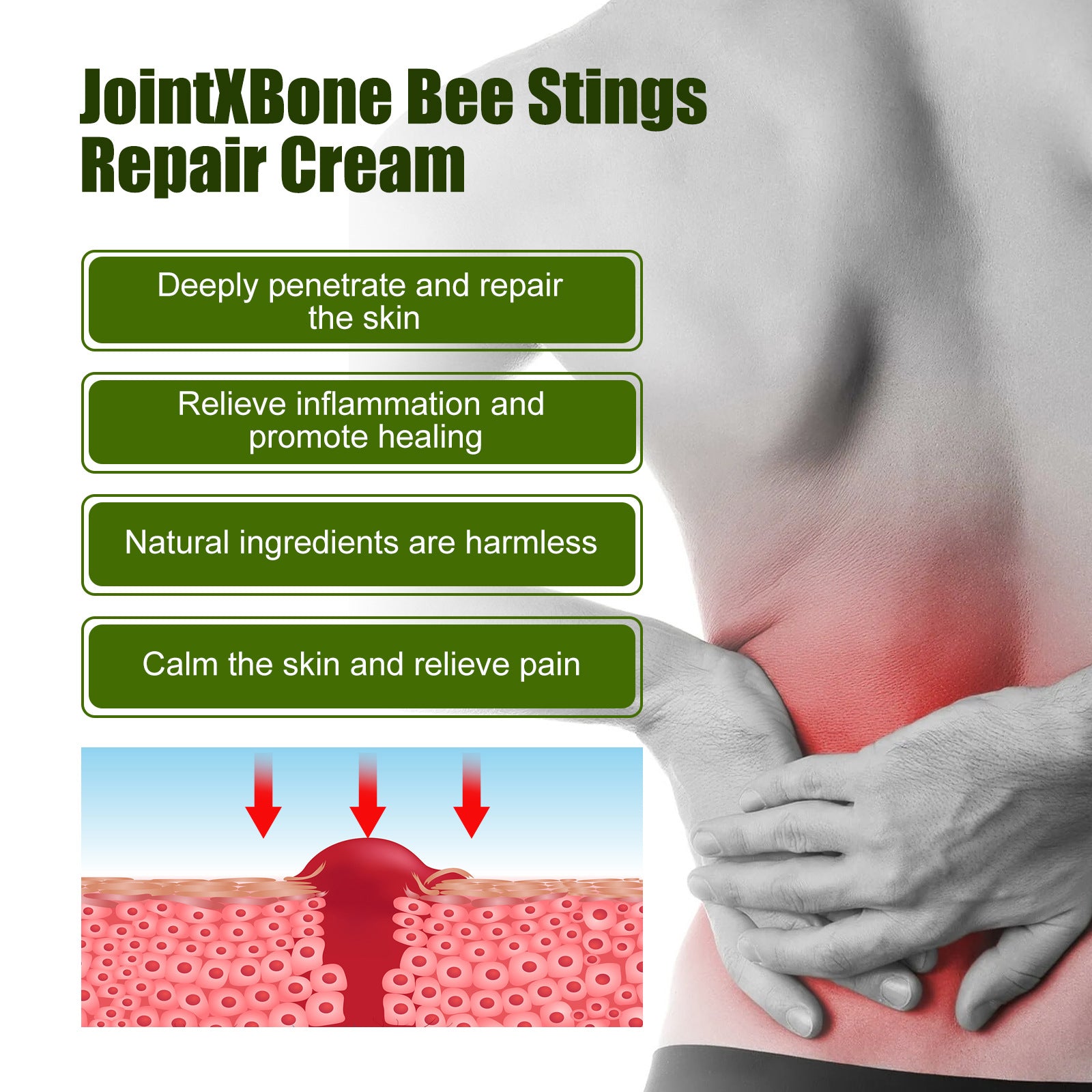 Bee Sting Pain Relief Cream