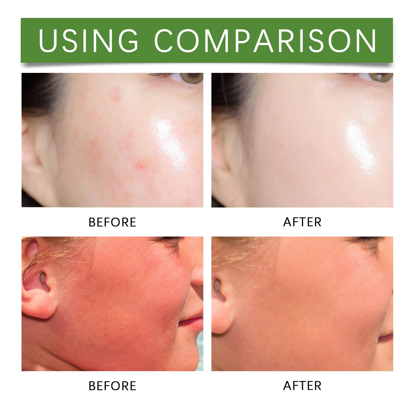 Aloe Skin Soothing Balm