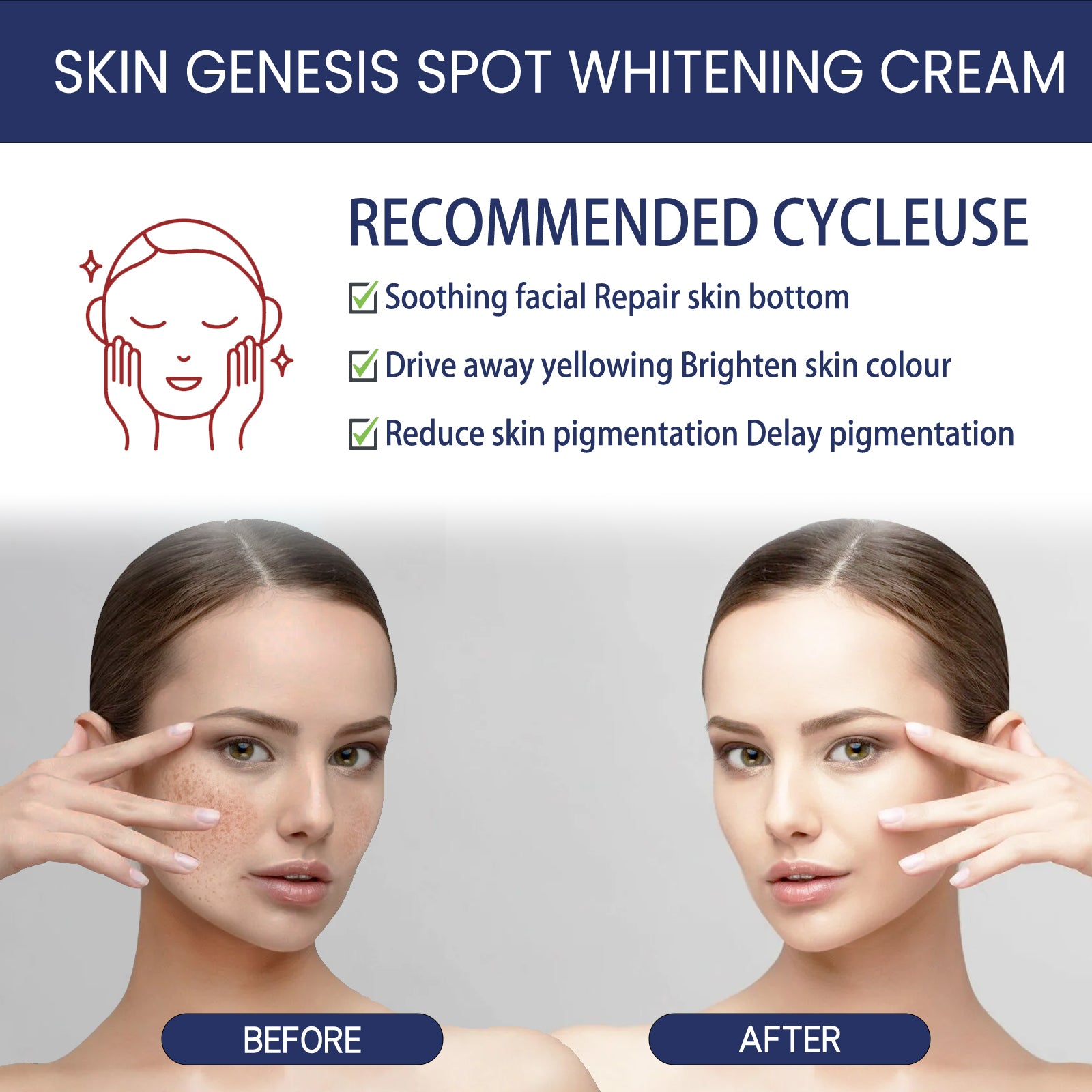 Crema hidratante blanqueadora 477