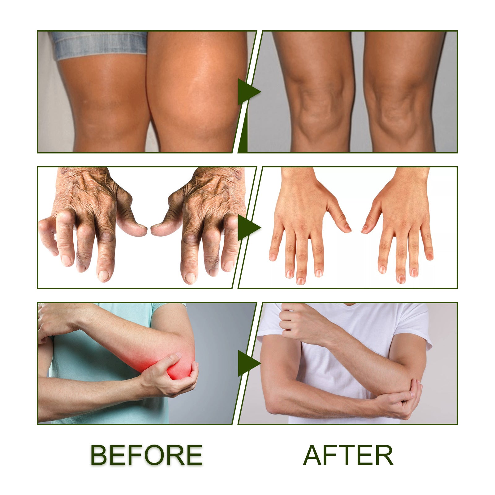 Bee Sting Pain Relief Cream