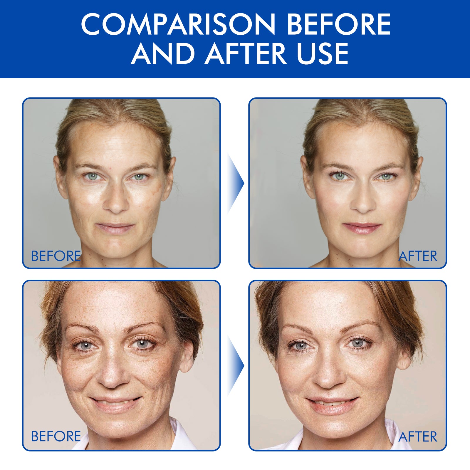 Firming Facial Botox Serum