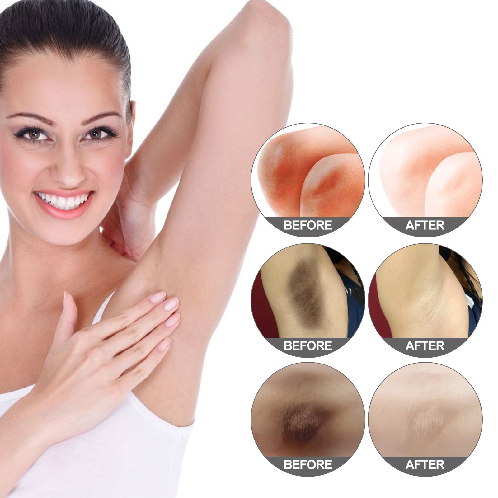 Crema blanqueadora Jaysuing