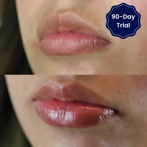 đGRAN OFERTA đ„SUERO LABIAL CON VITAMINA E