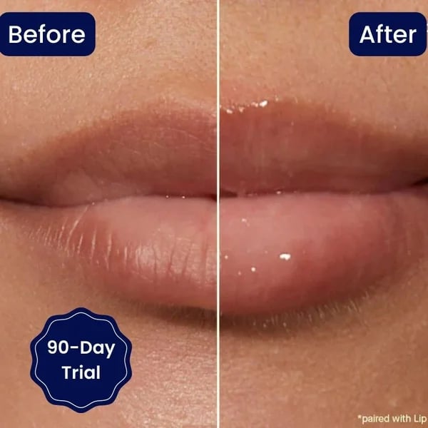 đGRAN OFERTA đ„SUERO LABIAL CON VITAMINA E