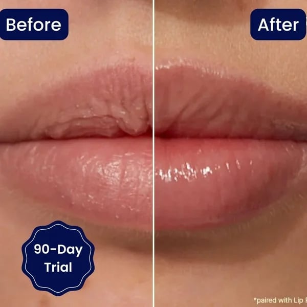 đGRAN OFERTA đ„SUERO LABIAL CON VITAMINA E